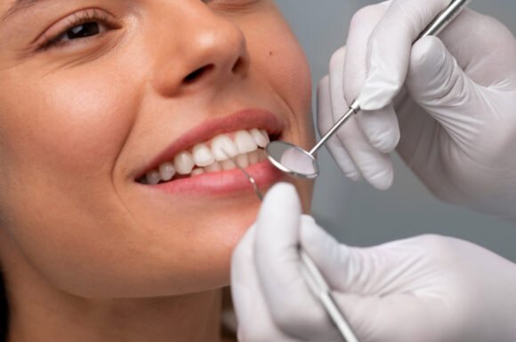 Zirconia Crowns